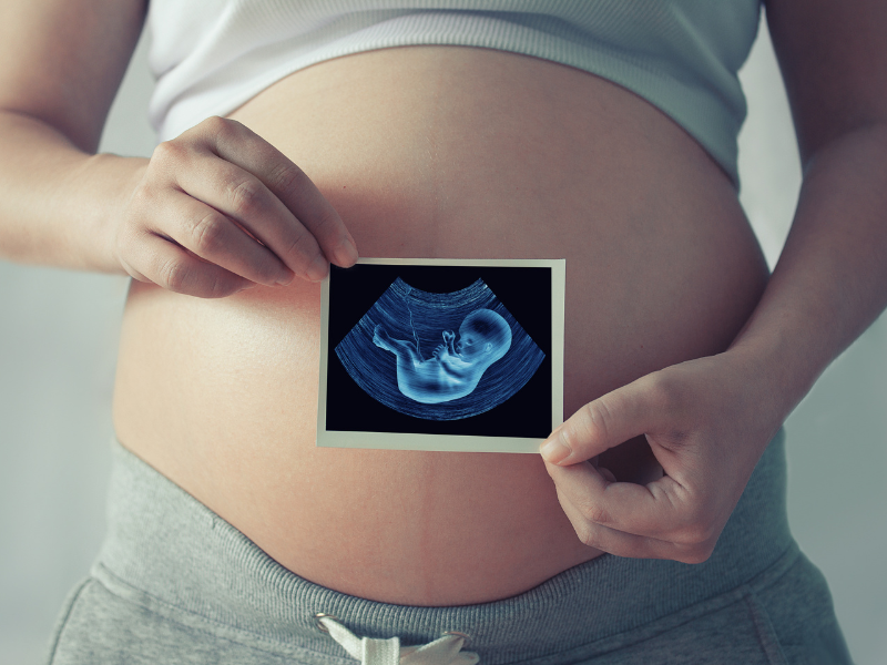 Life Extension Europe: Pregnancy bump with hands holding a pregnancy scan in front.